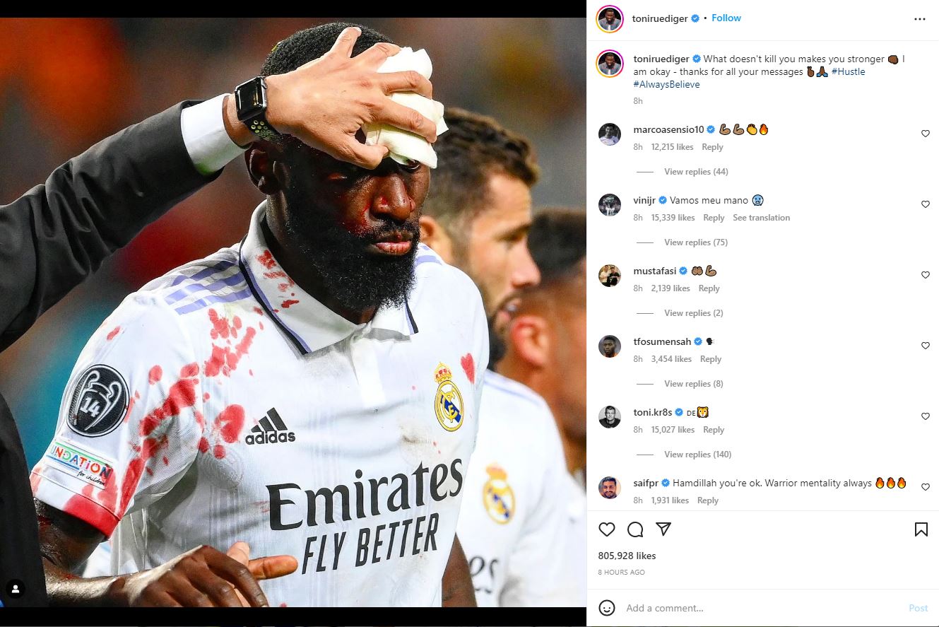 Antonio Rudiger, după accidentarea horror suferită în Șahtior - Real Madrid. Sursa foto. instagram.com/toniruediger/